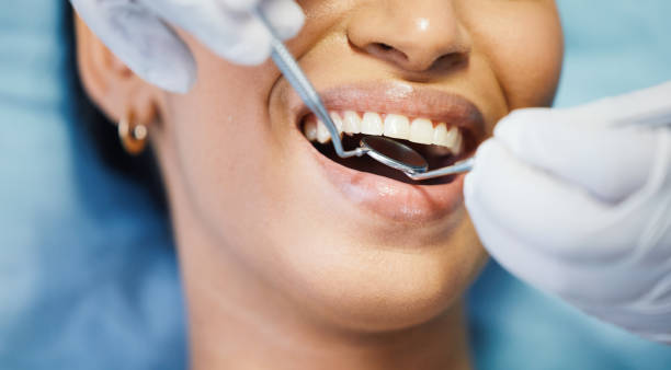 Best Emergency Dental Extractions in Navy, VA